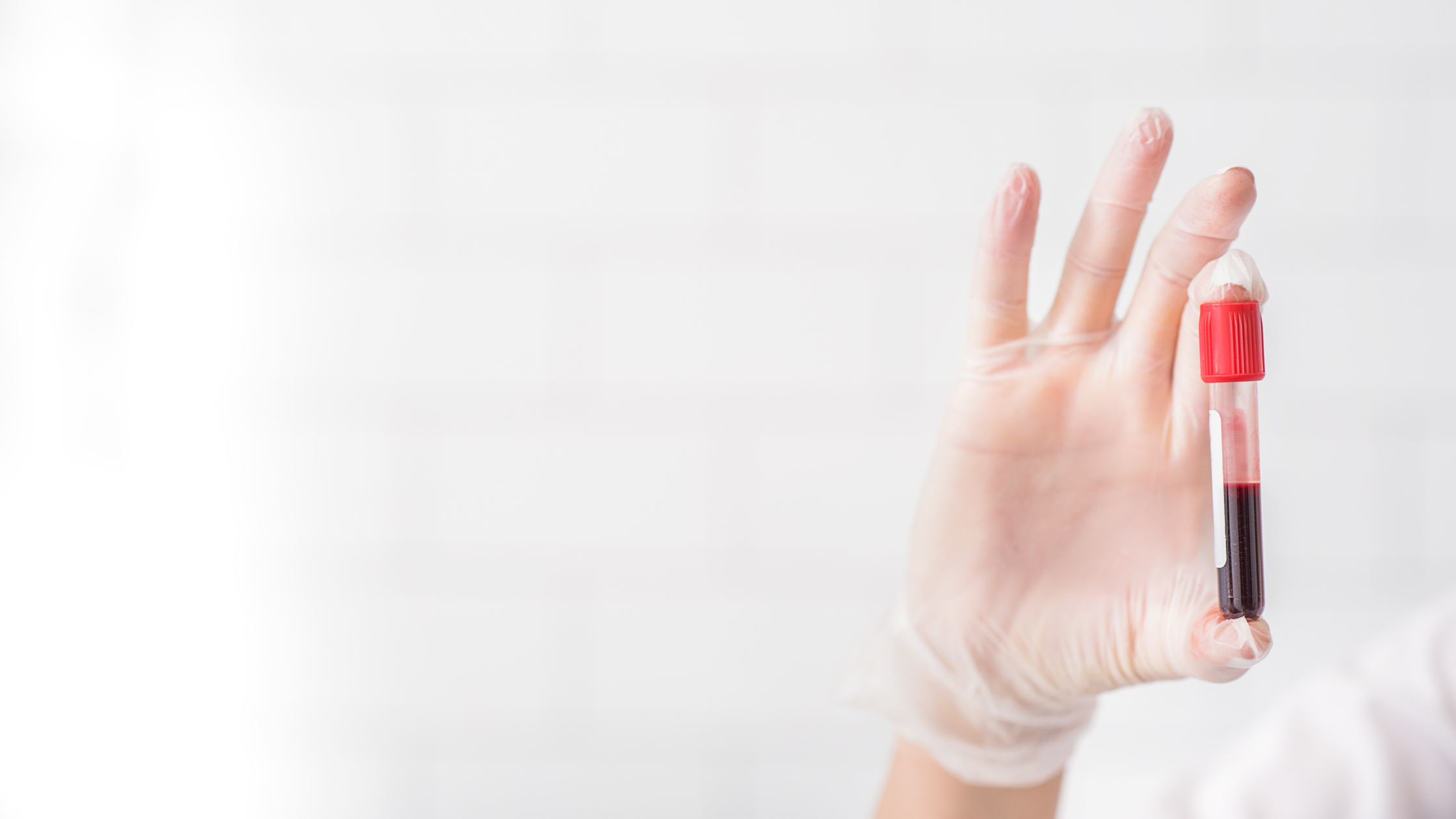 PRP Injections: What the Research Actually Says